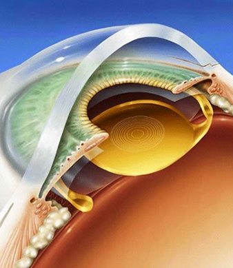 EYE-IMAGE